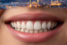 Gros plan d'une bouche affichant un sourire large et confiant avec des dents blanches et parfaitement alignées. L'arrière-plan est un panorama flou et chaleureux d'une ville moderne au crépuscule, avec des lumières scintillantes.