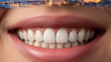 Gros plan d'une bouche affichant un sourire large et confiant avec des dents blanches et parfaitement alignées. L'arrière-plan est un panorama flou et chaleureux d'une ville moderne au crépuscule, avec des lumières scintillantes.