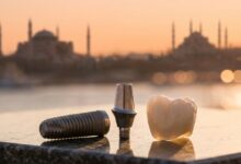 A photorealistic close-up of a complete dental implant's components—a titanium screw, an abutment, and a ceramic crown—with the iconic Istanbul skyline softly blurred in the background during a warm sunrise.