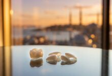 A close-up, photorealistic image of a perfect dental implant crown and veneers resting on a table, with the scenic, blurred skyline of Istanbul, Turkey visible in the background at sunset.