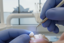 Close-up of a dental professional performing composite bonding on a patient's front tooth. Gloved hands are precisely shaping a tooth-colored resin material, with a subtle blue curing light visible. The background is a softly blurred, modern dental clinic, featuring a very faint and indistinct Australian city landmark through a window.