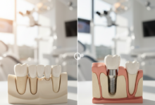 A photorealistic image showcasing a dental bridge on one side, with three crowns, two on natural teeth models, and a dental implant on the other, featuring a titanium post in a jawbone model, an abutment, and a crown. The background is a blurred, bright, modern dental clinic. No text visible.