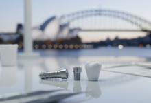 Close-up of a titanium dental implant screw, a metallic abutment, and a white ceramic dental crown, arranged on a reflective surface in a clean, high-tech setting. The background is a blurred, soft-focus image of an Australian coastal landscape or city skyline.